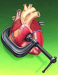 hypertonia