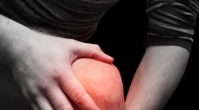 Муж, колено и… капуста