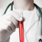 5 типов продуктов для повышения гемоглобина