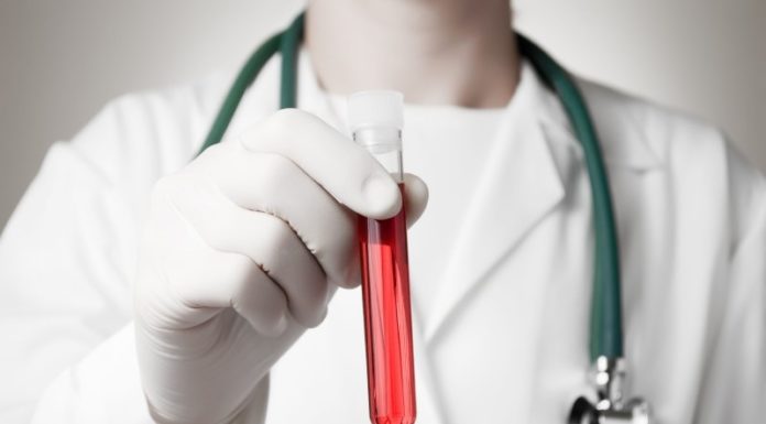 5 типов продуктов для повышения гемоглобина