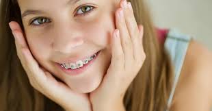 Какие брекеты поставить подростку?