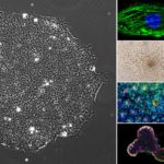Стволовые клетки в спортивной медицине и ортопедии