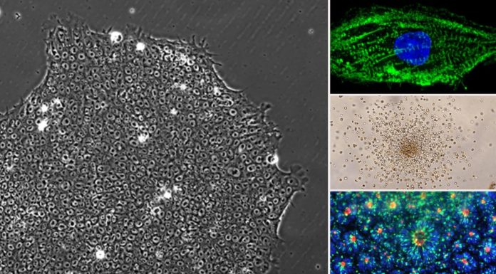 Стволовые клетки в спортивной медицине и ортопедии