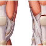 Эффективность лечебной физкультуры при повреждении связок коленного сустава