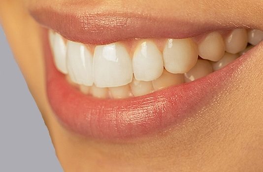 Виды металлокерамических коронок: их преимущества и недостатки