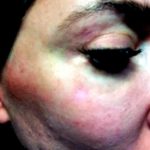 Lipo Lab для лица (Lipolab v-line for face) — отзывы о борьбе со вторым подбородком