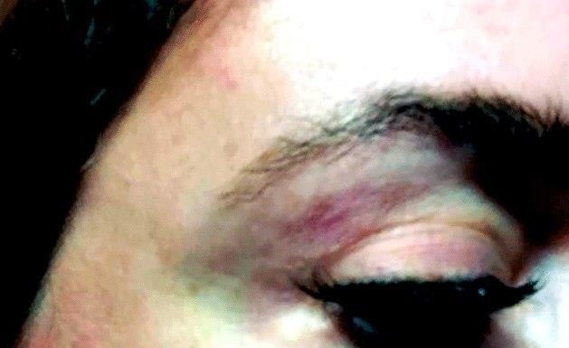 Lipo Lab для лица (Lipolab v-line for face) — отзывы о борьбе со вторым подбородком