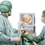 Показания к проведению артроскопии плечевого сустава