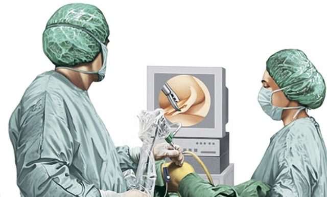 Показания к проведению артроскопии плечевого сустава