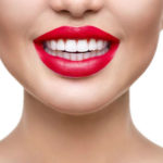 Голливудские улыбки-это виниры