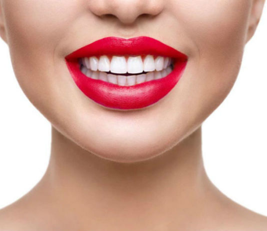 Голливудские улыбки-это виниры