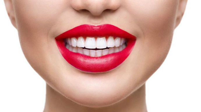 Голливудские улыбки-это виниры