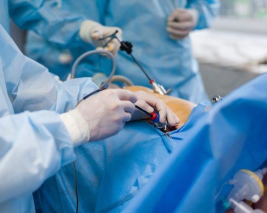 Оптимизация лапароскопической холецистэктомии