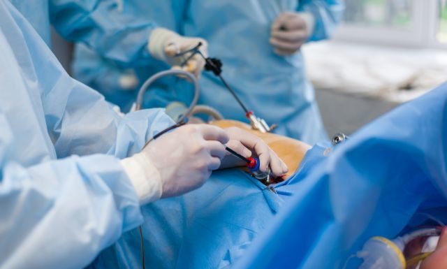 Оптимизация лапароскопической холецистэктомии