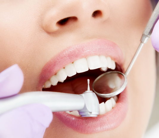 Почему нужно лечить кариес?