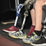 Как правильно подобрать тип крепления протеза голени?