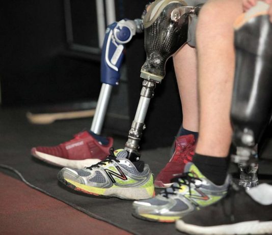 Как правильно подобрать тип крепления протеза голени?