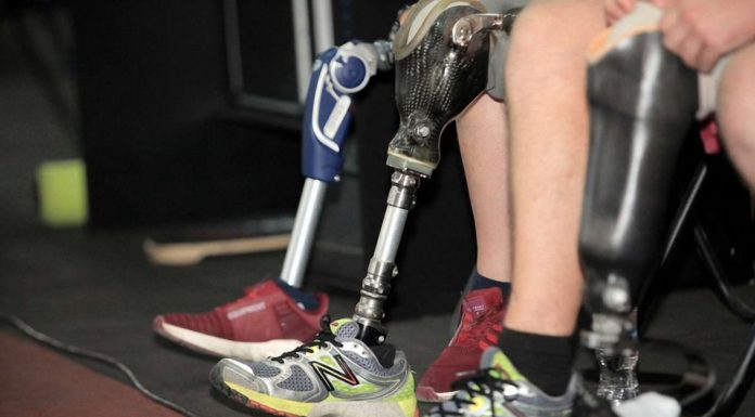 Как правильно подобрать тип крепления протеза голени?