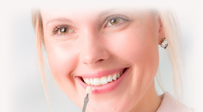 Зубные виниры – естественная красота вашей улыбки