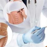 Чем занимается пластический хирург?