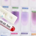 Какие анализы сдаются для диагностики коронавирусной инфекции?