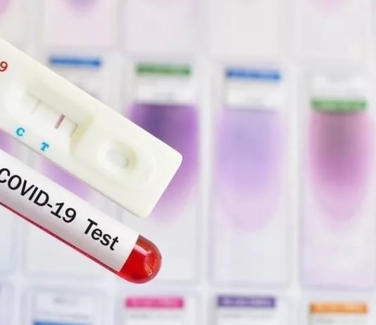 Какие анализы сдаются для диагностики коронавирусной инфекции?