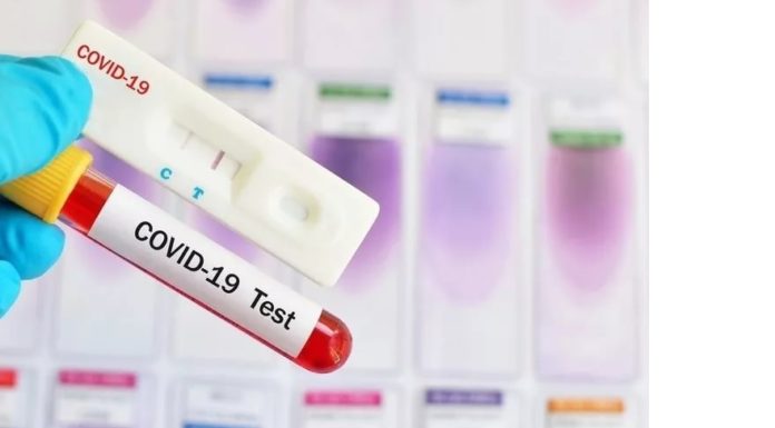 Какие анализы сдаются для диагностики коронавирусной инфекции?