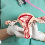 Гистерэктомия: показания и виды операции
