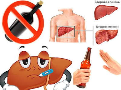 Алкогольный гепатит