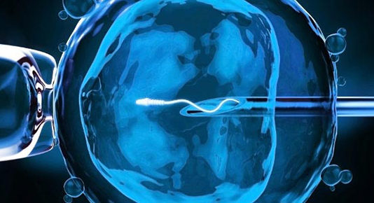 ЭКО — вспомогательная репродуктивная технология, применяемая при бесплодии