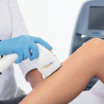 Правильный выбор аппарата для эпиляции