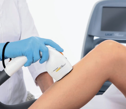 Правильный выбор аппарата для эпиляции