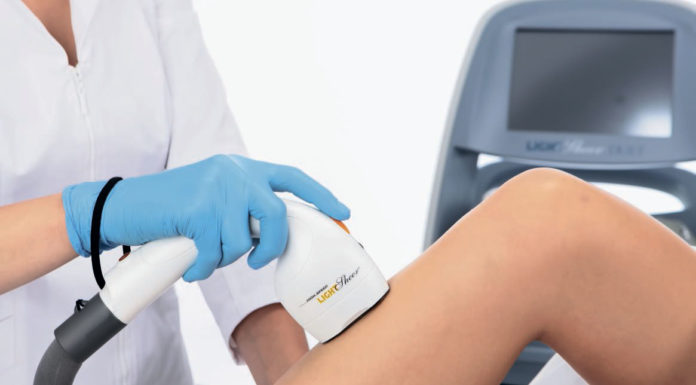 Правильный выбор аппарата для эпиляции