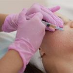 Мезотерапия: особенности процедуры