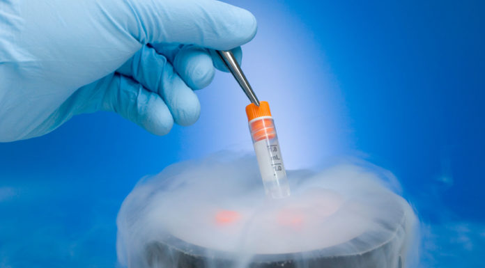 Как работает банк спермы