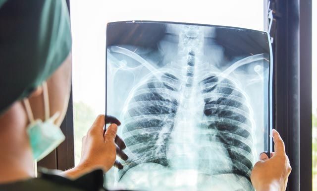 Как проходит восстановление после коронавируса?