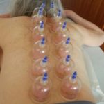 Какая польза от вакуумных банок?