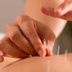 Как быстро наступает эффект от иглоукалывания?