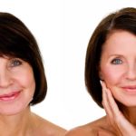 Ботокс для лица