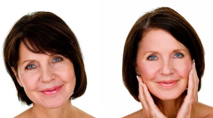 Ботокс для лица