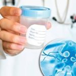 Спермограмма: как правильно сдавать анализ и расшифровывать результаты