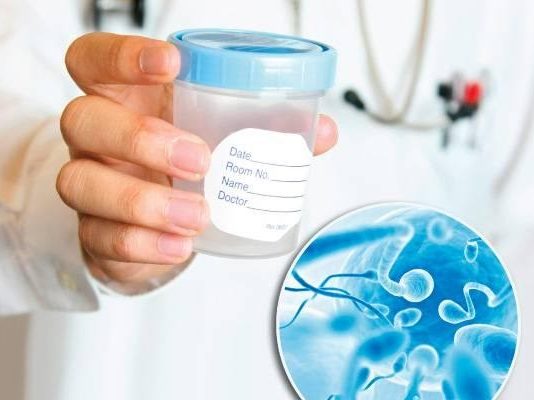 Спермограмма: как правильно сдавать анализ и расшифровывать результаты