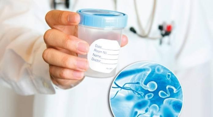 Спермограмма: как правильно сдавать анализ и расшифровывать результаты