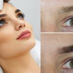 Что такое лазерная эпиляция бровей?