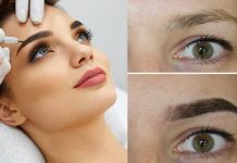 Что такое лазерная эпиляция бровей?