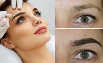 Что такое лазерная эпиляция бровей?