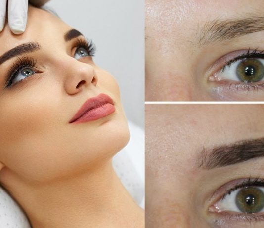 Что такое лазерная эпиляция бровей?