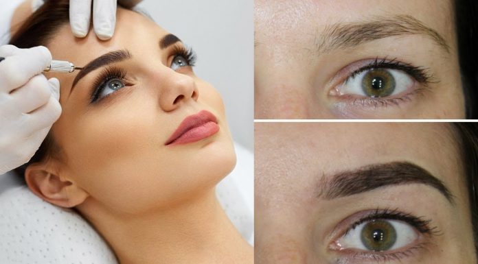 Что такое лазерная эпиляция бровей?