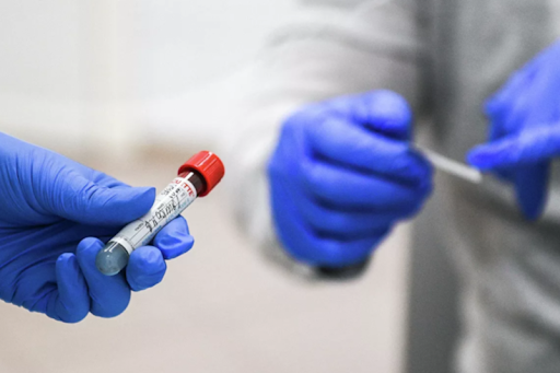 Как подготовиться к сдаче ПЦР-теста на COVID-19?