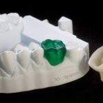 3Д принтеры в стоматологии: полезное новшество